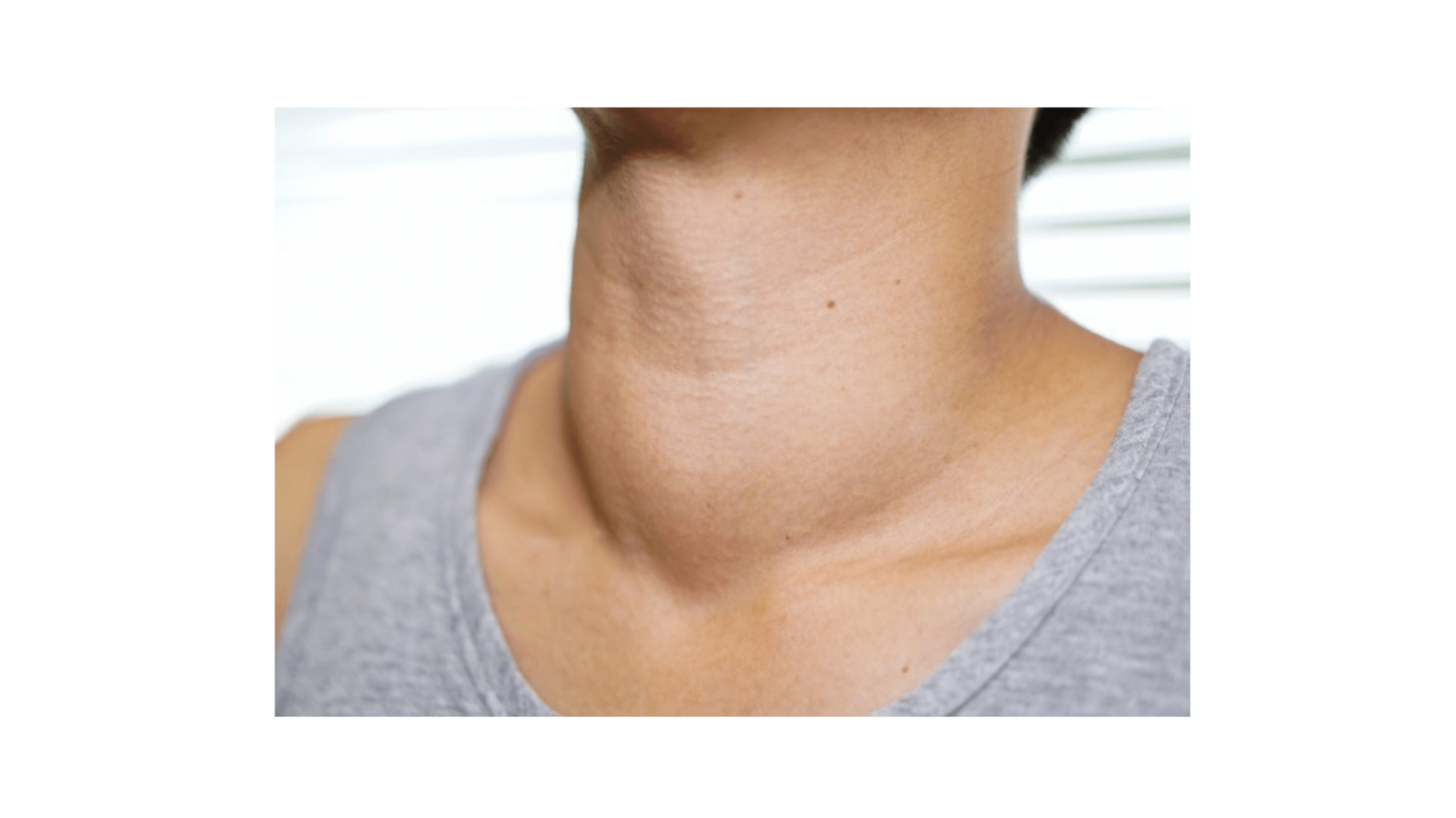 how-thyroid-can-be-detected-is-it-easy-to-cure